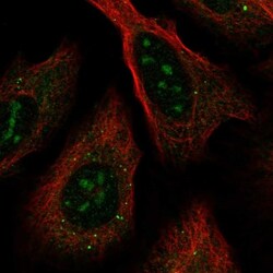 RRNAD1 Antibody, Novus Biologicals:Antibodies:Primary Antibodies